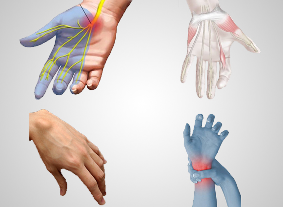 Patologias do punho e da mão
